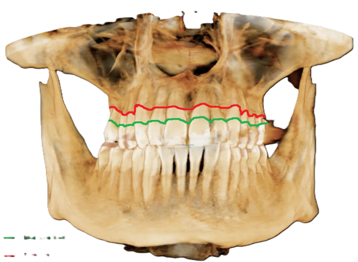 Orthodontics | Impressions Orthodontics & Dentistry